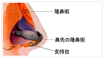 鼻筋整形について、鼻の中の構造を横から見た状態の図